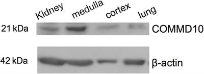 Epithelial Na+ Channel: Reciprocal Control by COMMD10 and Nedd4-2